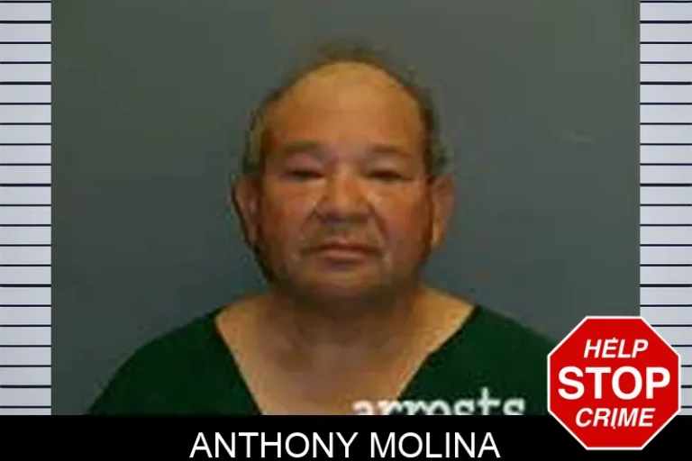 Anthony Molina