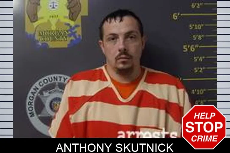 Anthony Skutnick
