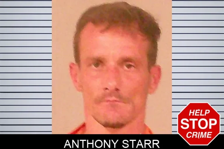 Anthony Starr
