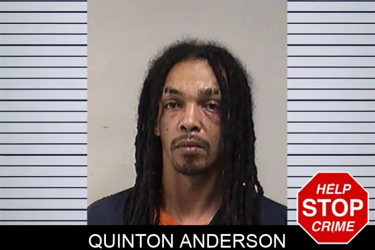 Quinton Anderson