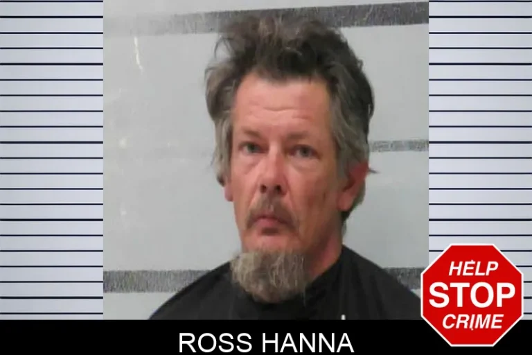 Ross Hanna