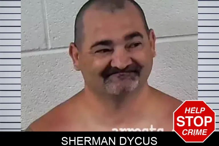 Sherman Dycus