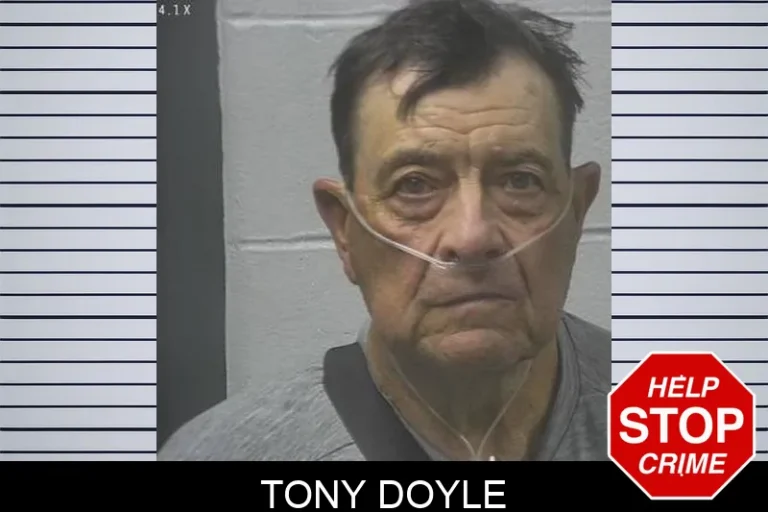 Tony Doyle