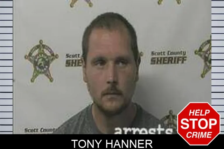 Tony Hanner