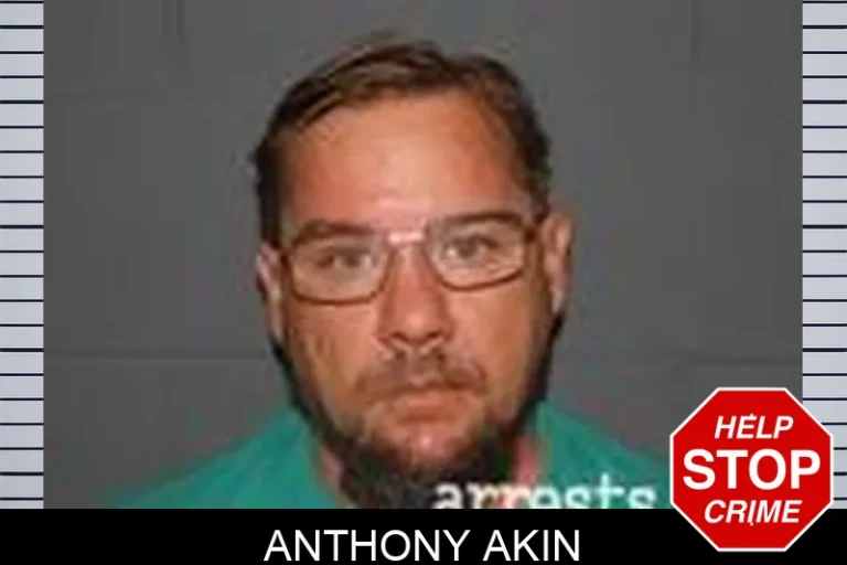 Anthony Akin