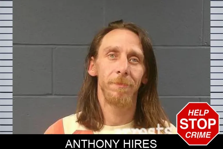 Anthony Hires