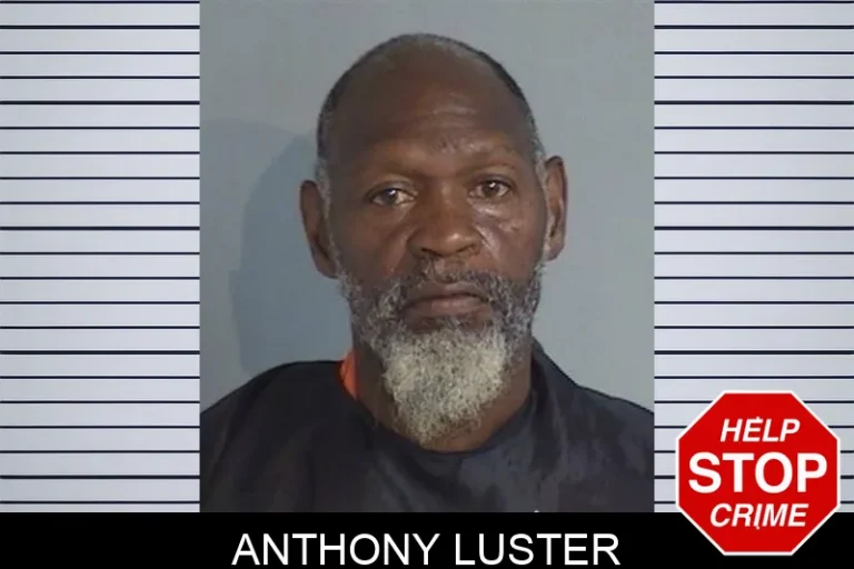 Anthony Luster