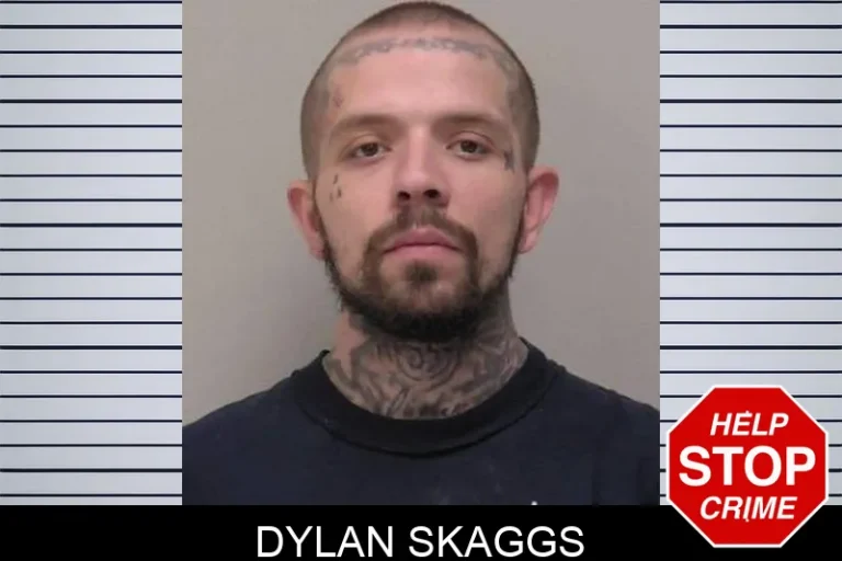 Dylan Skaggs
