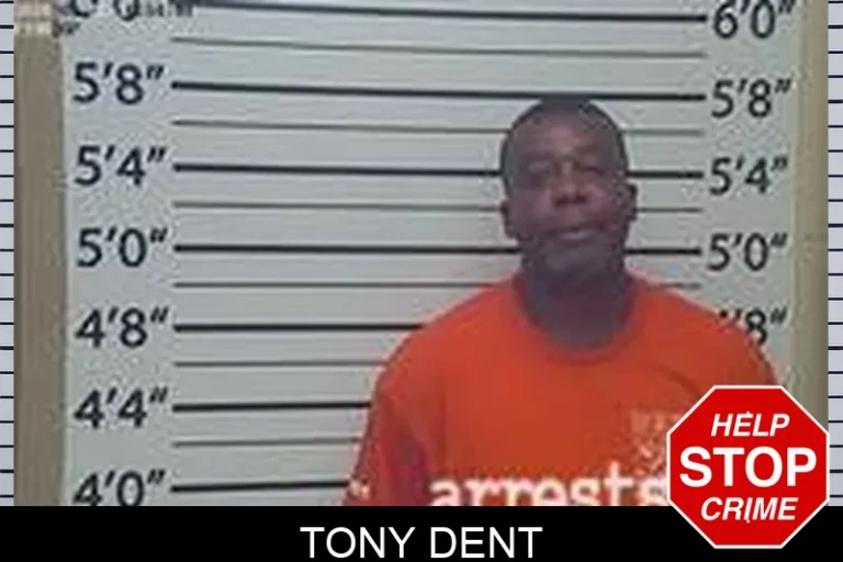 Tony Dent